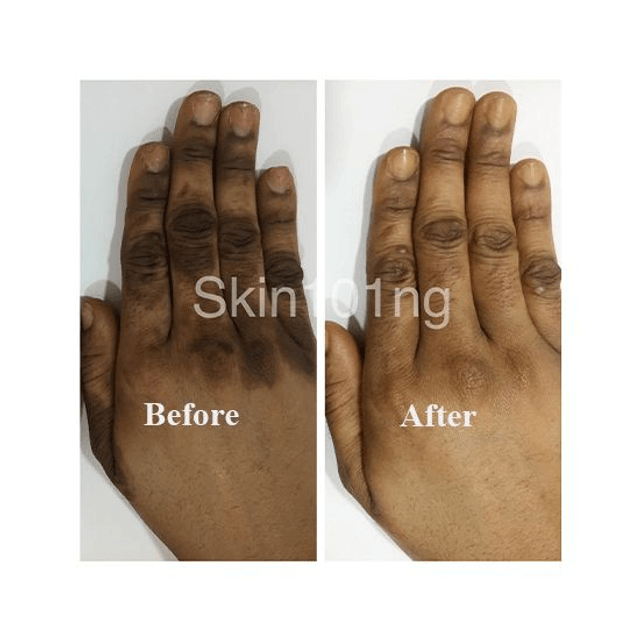 B.B. Clear Dark Spot Remover 30ml & Unifying Serum 30ml | Be Beautiful & Clear Skin | Repair Dark Spots & Sun Damage | Brigthening & Younger-looking